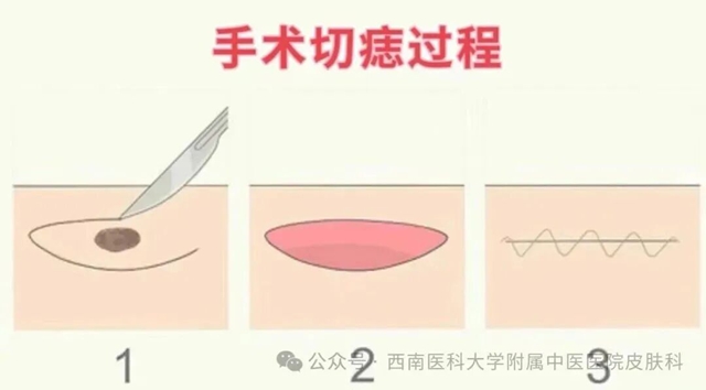 激光3.jpg