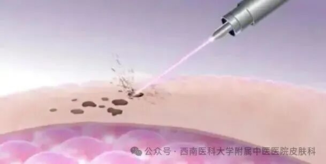 激光1.jpg