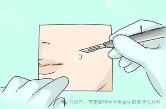 激光2.jpg