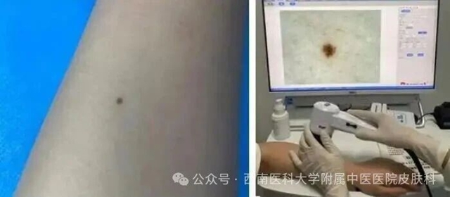 激光4.jpg