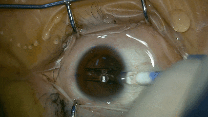 3.gif