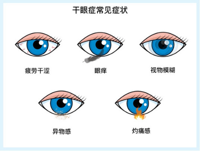 西南医大附院专家提醒：抗击新冠家里蹲，护眼常识需谨遵(图1)