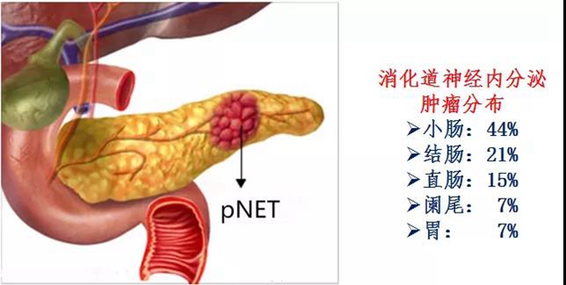 西南领先| 让隐匿“罪犯”显形，他们派上了终极“核武器”！(图3)