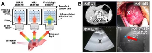 西南医大附院肝胆外科新技术登上SCI期刊封面