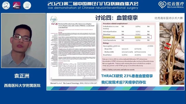 西南医大附院脑卒中团队袁正洲博士再次斩获全国冠军！(图2)