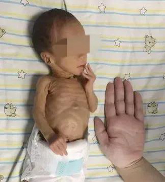 【喜讯】泸州唯一，西南医大中医院被国家卫健委点名表扬啦！(图12)