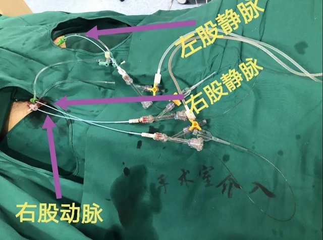 跻身国内先进水平!西南医大附院库欣病诊断技术获突破(图2) 跻身国内先进水平!西南医大附院库欣病诊断技术获突破(图2)