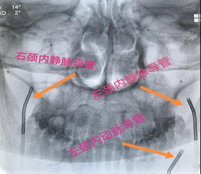 跻身国内先进水平!西南医大附院库欣病诊断技术获突破(图3) 跻身国内先进水平!西南医大附院库欣病诊断技术获突破(图3)