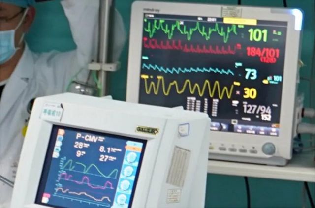 首例!救命的硬核武器—ECMO技术在西南医大附院成功开展(图3) 首例!救命的硬核武器—ECMO技术在西南医大附院成功开展(图3)