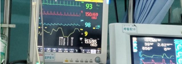 首例!救命的硬核武器—ECMO技术在西南医大附院成功开展(图7) 首例!救命的硬核武器—ECMO技术在西南医大附院成功开展(图7)