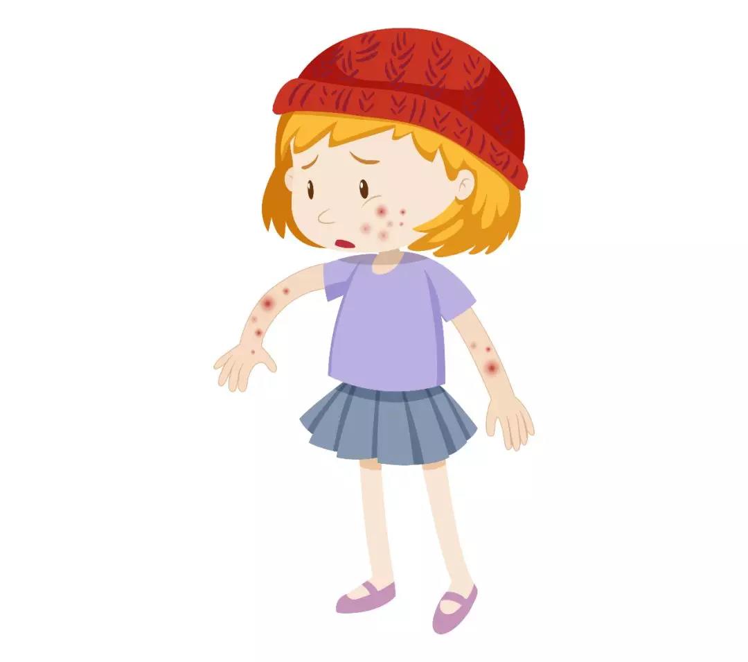 川南学生家长速看：当前已进入水痘高发期！(图2)