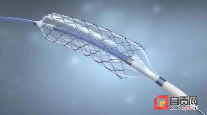 “百元级”冠脉支架落地自贡 全市6家三级医院均有采购