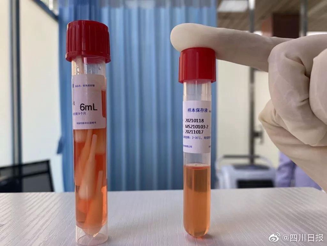 官宣！四川核酸检测不收挂号费，混检最低18元！