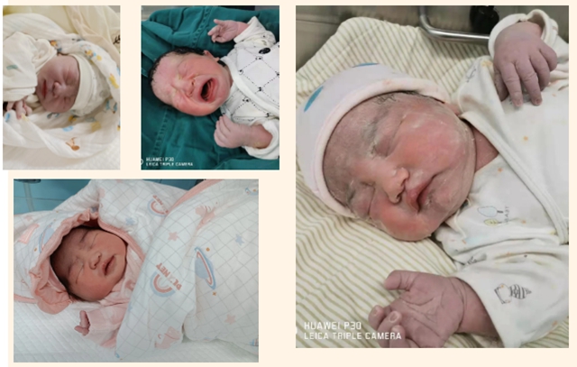 萌！西南医大中医院迎接了25名金牛宝宝！(图7)