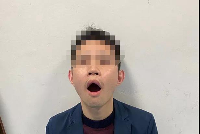 打个哈欠，泸州男子“合不拢嘴”了……