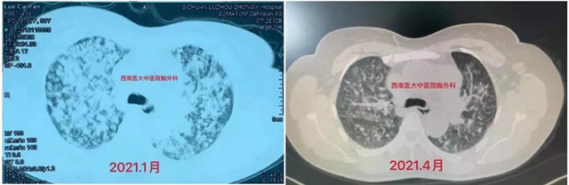 【关注】泸州孃孃冒雨摘樱桃,送帅哥医生?(图4) 【关注】泸州孃孃冒雨摘樱桃,送帅哥医生?(图4)