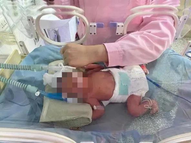 生命“闯关”！隆昌这家医院拯救了一对龙凤胎早产儿(图2)