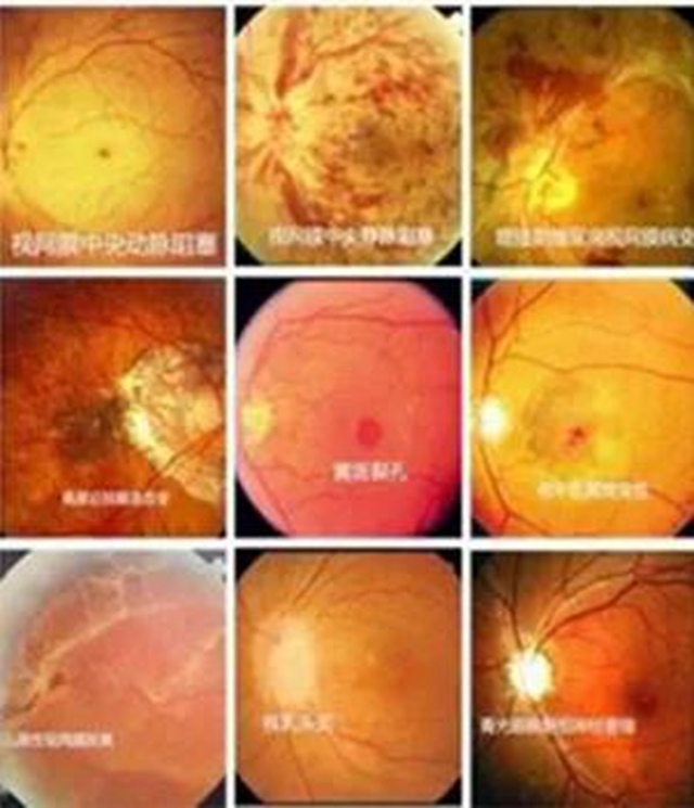 6月4日全天，西南医大附院眼科医生在门诊大厅等你！(图8)