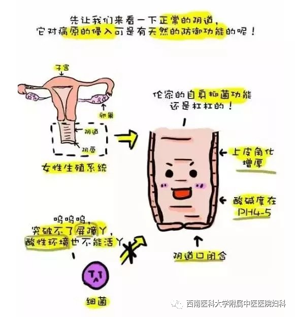 【关注】女性私处千万别过度清洁，可能会……(图2)