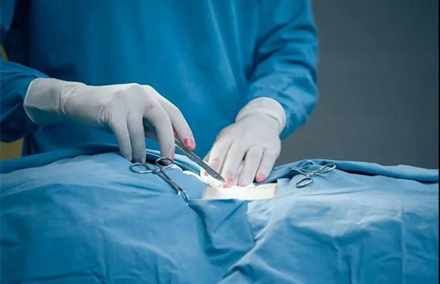 【围观】真猛!男子竟自己割包皮?(图8) 【围观】真猛!男子竟自己割包皮?(图8)