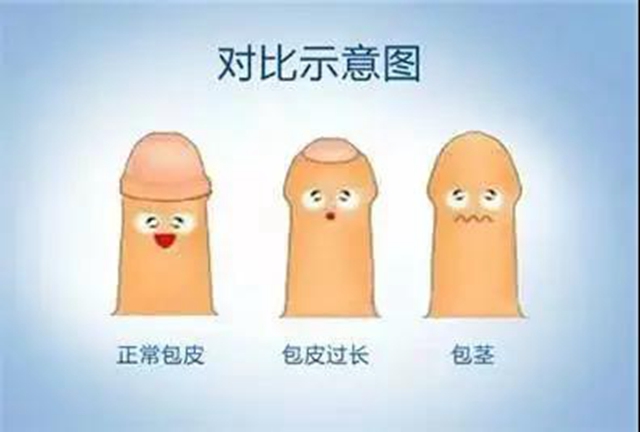 【围观】真猛!男子竟自己割包皮?(图11) 【围观】真猛!男子竟自己割包皮?(图11)