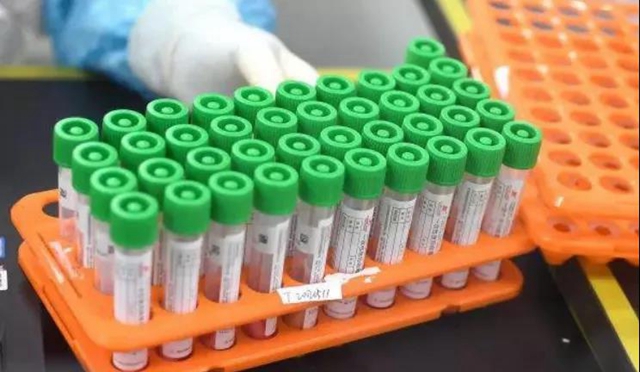 南京禄口机场地服人员多人检出新冠病毒核酸阳性,泸州市疾控中心紧急提示(图1) 南京禄口机场地服人员多人检出新冠病毒核酸阳性,泸州市疾控中心紧急提示(图1)