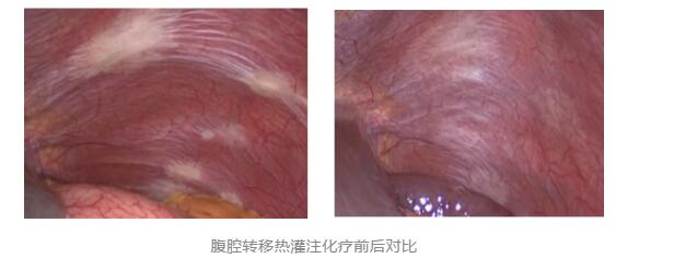 【关注】43℃高温下，被烫死了……(图8)