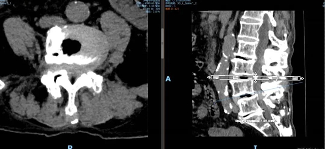 人生考试!看一位17+92岁的老生如何逆袭?(图1) 人生考试!看一位17+92岁的老生如何逆袭?(图1)