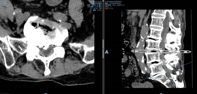 人生考试!看一位17+92岁的老生如何逆袭?(图3) 人生考试!看一位17+92岁的老生如何逆袭?(图3)