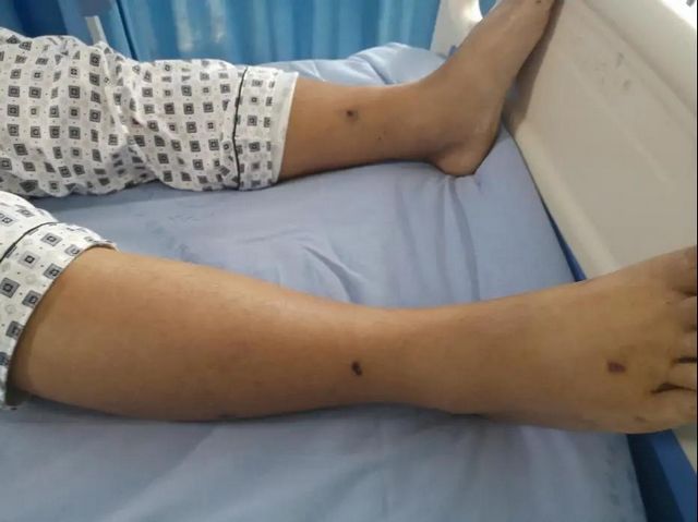 13人惨遭意外袭击，如果你遇到了要这样自救(图2)