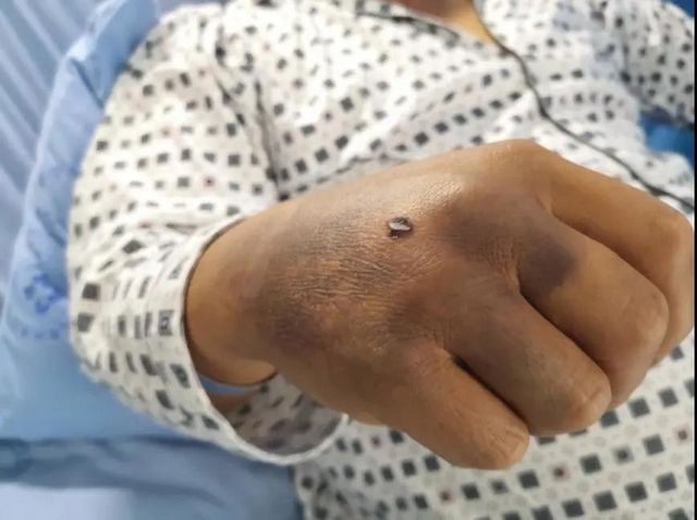 13人惨遭意外袭击，如果你遇到了要这样自救