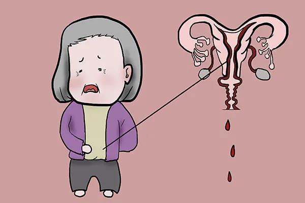 【扩散】88岁老奶奶下体掉了块“肉”？(图5)