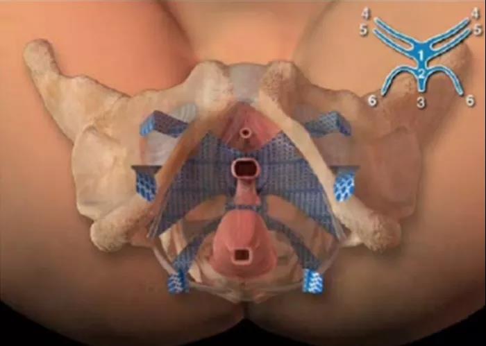 【扩散】88岁老奶奶下体掉了块“肉”？(图6)