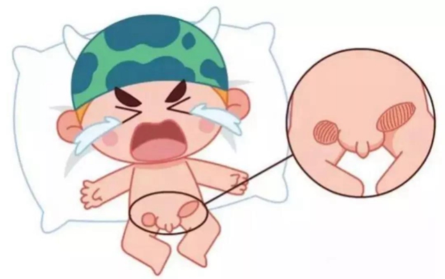宝宝排尿鼓包图片图片