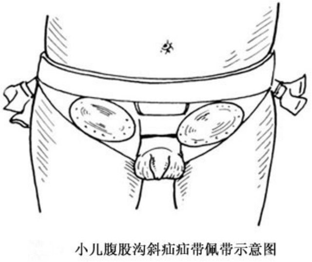 【扩散】孩子哭闹后大腿根鼓个包？居然是……(图7)