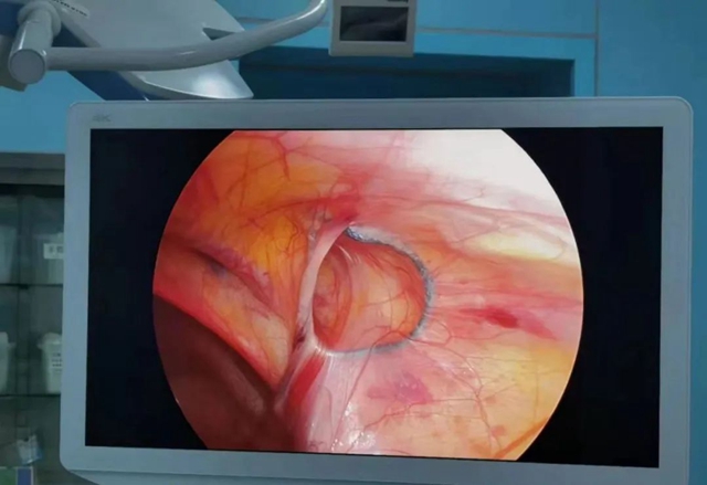 【扩散】孩子哭闹后大腿根鼓个包？居然是……(图8)