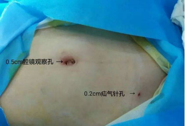 【扩散】孩子哭闹后大腿根鼓个包？居然是……(图9)