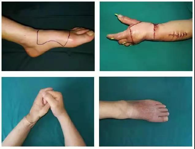 【关注】购物节,他们竟真把手“剁了”?(图2) 【关注】购物节,他们竟真把手“剁了”?(图2)