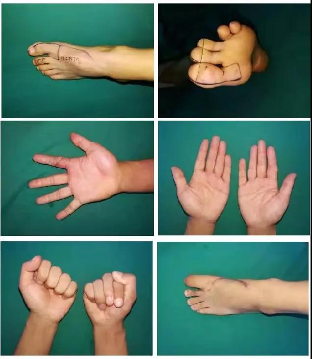 【关注】购物节,他们竟真把手“剁了”?(图5) 【关注】购物节,他们竟真把手“剁了”?(图5)