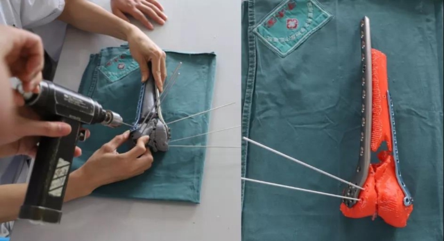 【危险】50岁大叔高处摔下,差点……(图3) 【危险】50岁大叔高处摔下,差点……(图3)