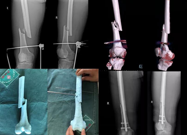 【危险】50岁大叔高处摔下,差点……(图4) 【危险】50岁大叔高处摔下,差点……(图4)