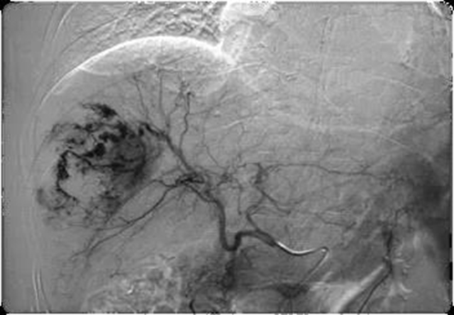 【扩散】西南医大中医院肝胆病科搬新家啦，超燃！(图8)