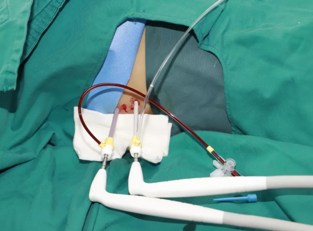 【扩散】肝癌患者请注意，西南医大中医院可免费治疗！(图9)