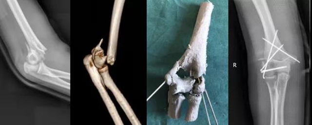 【惊险】6人摔得“粉身碎骨”？(图8)