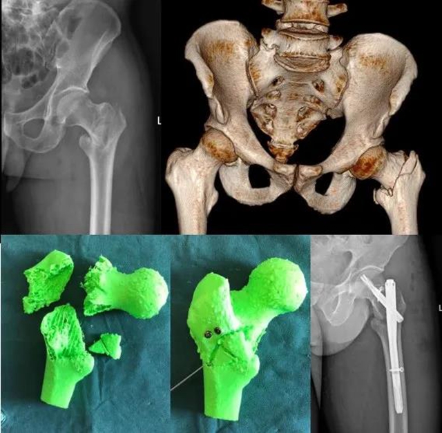 【惊险】6人摔得“粉身碎骨”？(图9)