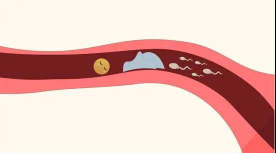【关注】年轻夫妻3年未孕！检查前1天出啥事了？(图7)