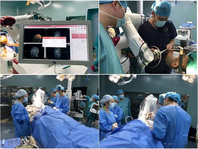 【义诊在即】它被称为“不死的癌症”,手抖只是其中一种表现(图4) nEO_IMG_3.jpg