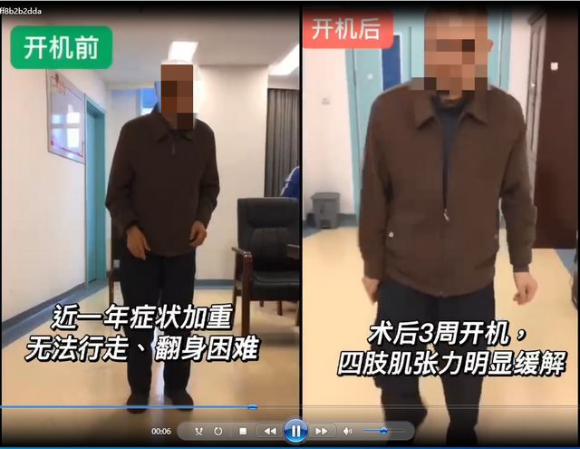 【义诊在即】它被称为“不死的癌症”,手抖只是其中一种表现(图5) 4.jpg