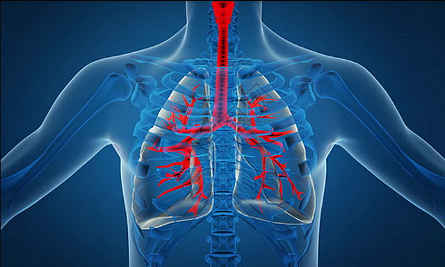 【警惕】无发热、无咳嗽,多例患者却确诊大白肺、呼吸衰竭.......(图7) nEO_IMG_7.jpg