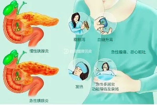 【警惕】痛痛痛,痛如刀割,这样的肚子痛当心要手术......(图4) nEO_IMG_4.jpg